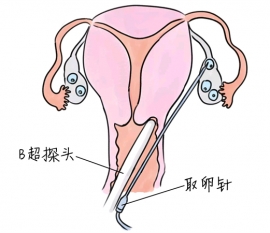 幼儿学画画，南京捐卵宝宝学画画，学画画的好处，如何学画画