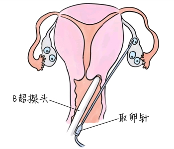 幼儿学画画，南京捐卵宝宝学画画，学画画的好处，如何学画画